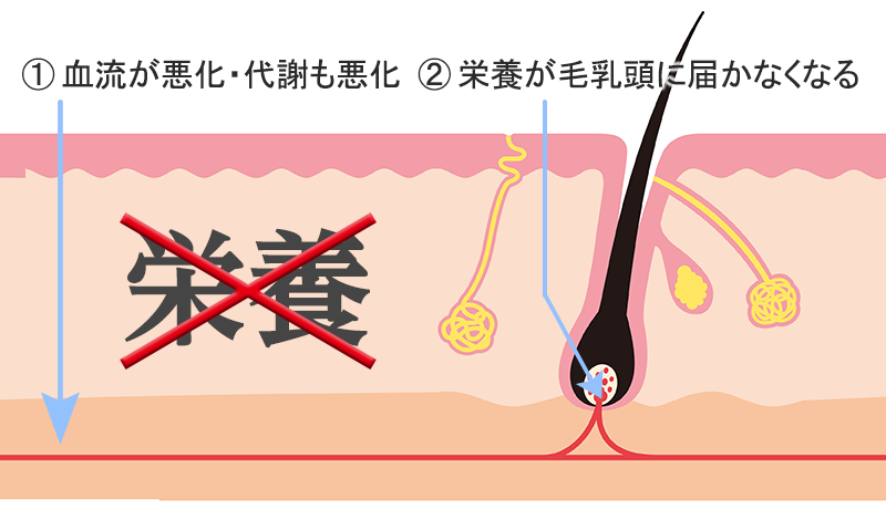 減量によるストレスと脱毛